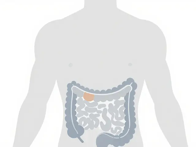 Diverticulitis: Understanding Inflamed Pouches and Modern Treatment Approaches
